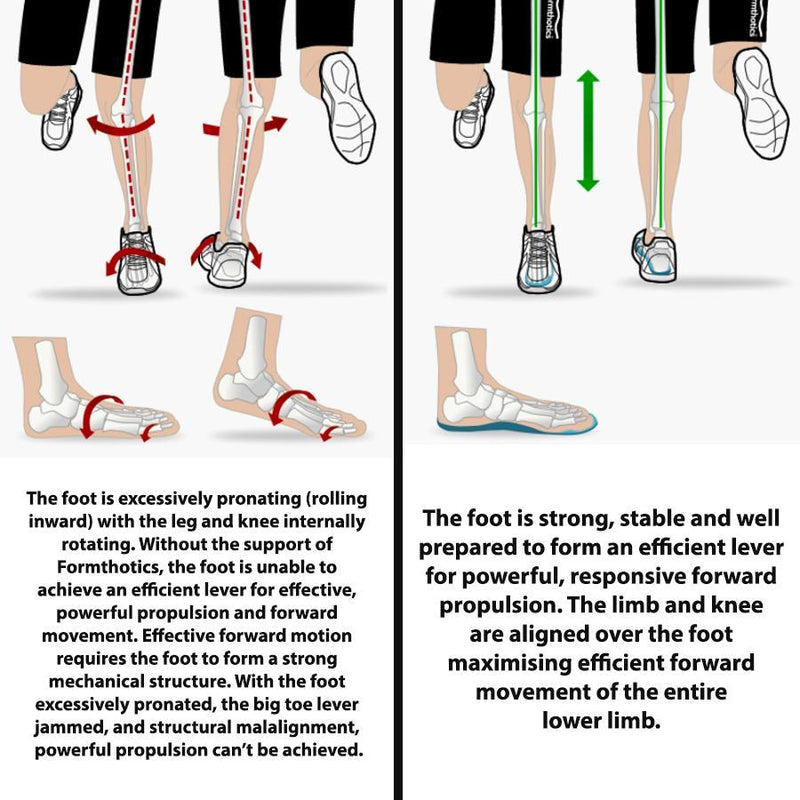 Formthotics Run Dual Orthotics